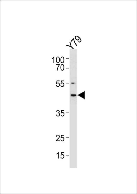 RDH10 Antibody - RDH10 Antibody western blot of Y79 cell line lysates (35 ug/lane). The RDH10 antibody detected the RDH10 protein (arrow).