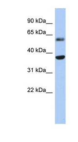 RDH10 Antibody - RDH10 antibody Western blot of Fetal Heart lysate.  This image was taken for the unconjugated form of this product. Other forms have not been tested.