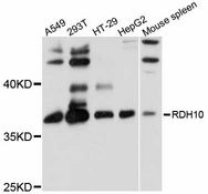 RDH10 Antibody - Western blot analysis of extracts of various cell lines, using RDH10 antibody at 1:1000 dilution. The secondary antibody used was an HRP Goat Anti-Rabbit IgG (H+L) at 1:10000 dilution. Lysates were loaded 25ug per lane and 3% nonfat dry milk in TBST was used for blocking. An ECL Kit was used for detection and the exposure time was 10s.
