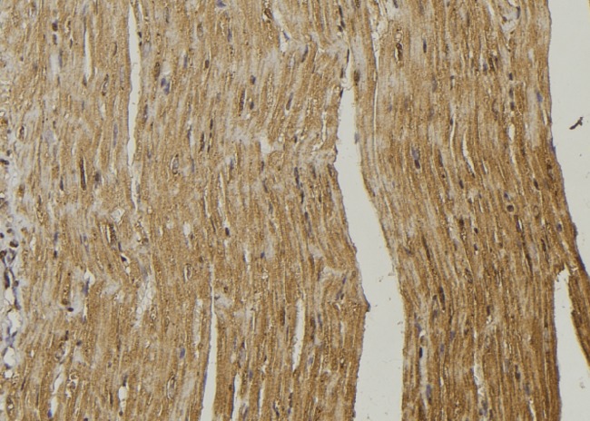 RDH10 Antibody - 1:100 staining mouse muscle tissue by IHC-P. The sample was formaldehyde fixed and a heat mediated antigen retrieval step in citrate buffer was performed. The sample was then blocked and incubated with the antibody for 1.5 hours at 22°C. An HRP conjugated goat anti-rabbit antibody was used as the secondary.