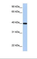 RDH11 Antibody - Fetal heart lysate. Antibody concentration: 1.0 ug/ml. Gel concentration: 12%.  This image was taken for the unconjugated form of this product. Other forms have not been tested.