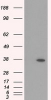 RDH11 Antibody - HEK293T cells were transfected with the pCMV6-ENTRY control (Left lane) or pCMV6-ENTRY RDH11 (Right lane) cDNA for 48 hrs and lysed. Equivalent amounts of cell lysates (5 ug per lane) were separated by SDS-PAGE and immunoblotted with anti-RDH11.