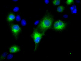 RDH11 Antibody - Anti-RDH11 mouse monoclonal antibody  immunofluorescent staining of COS7 cells transiently transfected by pCMV6-ENTRY RDH11.