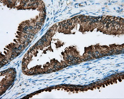 RDH11 Antibody - IHC of paraffin-embedded prostate tissue using anti-RDH11 mouse monoclonal antibody. (Dilution 1:50).