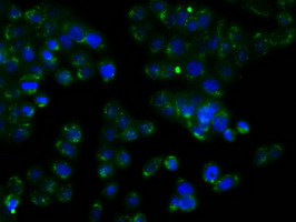 RDH11 Antibody - Immunofluorescent staining of HT29 cells using anti-RDH11 mouse monoclonal antibody.