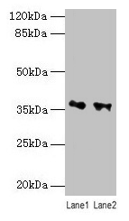 RDH11 Antibody - Western blot All lanes: RDH11 antibody at 10µg/ml Lane 1: PC-3 whole cell lysate Lane 2: Hela whole cell lysate Secondary Goat polyclonal to rabbit IgG at 1/10000 dilution Predicted band size: 36, 35, 28 kDa Observed band size: 36 kDa