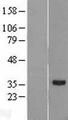 RDH11 Protein - Western validation with an anti-DDK antibody * L: Control HEK293 lysate R: Over-expression lysate