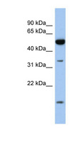 RDH12 / LCA3 Antibody - RDH12 antibody Western blot of Fetal Intestine lysate. This image was taken for the unconjugated form of this product. Other forms have not been tested.