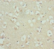 RDH12 / LCA3 Antibody - Immunohistochemistry of paraffin-embedded human brain tissue at dilution 1:100