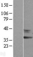 RDH12 / LCA3 Protein - Western validation with an anti-DDK antibody * L: Control HEK293 lysate R: Over-expression lysate