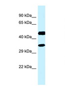 RDH13 Antibody - RDH13 antibody Western blot of Fetal Kidney lysate. Antibody concentration 1 ug/ml.  This image was taken for the unconjugated form of this product. Other forms have not been tested.