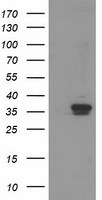 RDH14 Antibody - HEK293T cells were transfected with the pCMV6-ENTRY control (Left lane) or pCMV6-ENTRY RDH14 (Right lane) cDNA for 48 hrs and lysed. Equivalent amounts of cell lysates (5 ug per lane) were separated by SDS-PAGE and immunoblotted with anti-RDH14.