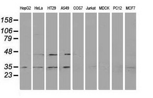RDH14 Antibody - Western blot of extracts (35ug) from 9 different cell lines by using anti-RDH14 monoclonal antibody.