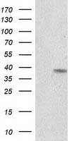 RDH14 Antibody - HEK293T cells were transfected with the pCMV6-ENTRY control (Left lane) or pCMV6-ENTRY RDH14 (Right lane) cDNA for 48 hrs and lysed. Equivalent amounts of cell lysates (5 ug per lane) were separated by SDS-PAGE and immunoblotted with anti-RDH14.