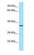 RDH8 Antibody - RDH8 antibody Western Blot of A549.  This image was taken for the unconjugated form of this product. Other forms have not been tested.