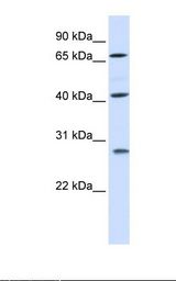 RDM1 Antibody - Placenta lysate. Antibody concentration: 1.0 ug/ml. Gel concentration: 12%.  This image was taken for the unconjugated form of this product. Other forms have not been tested.