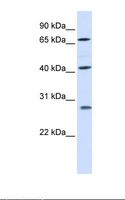 RDM1 Antibody - Placenta lysate. Antibody concentration: 1.0 ug/ml. Gel concentration: 12%.  This image was taken for the unconjugated form of this product. Other forms have not been tested.