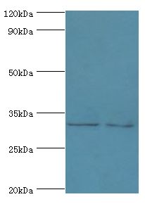 RDM1 Antibody - Western blot. All lanes: RDM1 antibody at 4 ug/ml. Lane 1: PC-3 whole cell lysate. Lane 2: MCF-7 whole cell lysate. Secondary antibody: Goat polyclonal to rabbit at 1:10000 dilution. Predicted band size: 32 kDa. Observed band size: 32 kDa.