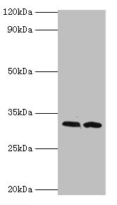 RDM1 Antibody - Western blot All lanes: RDM1 antibody at 4µg/ml Lane 1: PC-3 whole cell lysate Lane 2: MCF-7 whole cell lysate Secondary Goat polyclonal to rabbit IgG at 1/10000 dilution Predicted band size: 32, 30, 16, 14, 29, 26, 9, 13, 19, 27 kDa Observed band size: 32 kDa