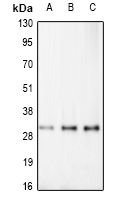 RDM1 Antibody - Western blot analysis of RAD52B expression in HEK293T (A); Raw264.7 (B); H9C2 (C) whole cell lysates.