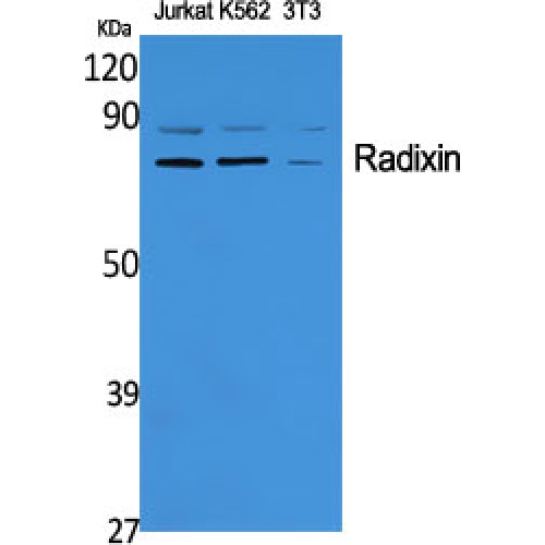 RDX / Radixin Antibody - Western blot of Radixin antibody