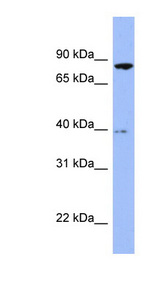 RDX / Radixin Antibody - RDX / Radixin antibody Western blot of Fetal Brain lysate. This image was taken for the unconjugated form of this product. Other forms have not been tested.