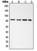 RDX / Radixin Antibody - Western blot analysis of Radixin expression in A431 (A); K562 (B); NIH3T3 (C); PC12 (D) whole cell lysates.