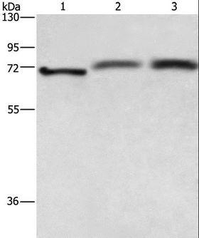 RDX / Radixin Antibody - Western blot analysis of HeLa cell, human fetal brain and hepatocellular carcinoma tissue, using RDX Polyclonal Antibody at dilution of 1:700.