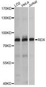 RDX / Radixin Antibody - Western blot analysis of extracts of various cell lines, using RDX antibody at 1:1000 dilution. The secondary antibody used was an HRP Goat Anti-Rabbit IgG (H+L) at 1:10000 dilution. Lysates were loaded 25ug per lane and 3% nonfat dry milk in TBST was used for blocking. An ECL Kit was used for detection and the exposure time was 1s.