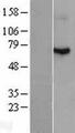 RDX / Radixin Protein - Western validation with an anti-DDK antibody * L: Control HEK293 lysate R: Over-expression lysate
