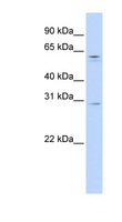 REC8 Antibody - REC8 antibody Western blot of 721_B cell lysate. This image was taken for the unconjugated form of this product. Other forms have not been tested.