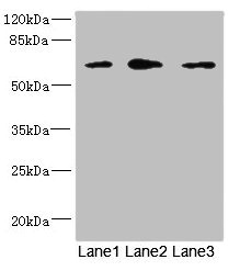 REC8 Antibody - Western blot All Lanes: REC8 antibody at 1.67ug/ml Lane 1: Jurkat whole cell lysate Lane 2: HT29 whole cell lysate Lane 3: HepG-2 whole cell lysate Secondary Goat polyclonal to rabbit IgG at 1/10000 dilution Predicted band size: 63,61 kDa Observed band size: 63 kDa