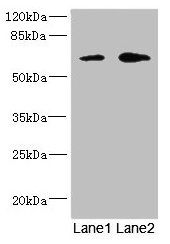 REC8 Antibody - Western blot All lanes: REC8 antibody at 1.67µg/ml Lane 1: Jurkat whole cell lysate Lane 2: HT29 whole cell lysate Secondary Goat polyclonal to rabbit IgG at 1/10000 dilution Predicted band size: 63, 61 kDa Observed band size: 63 kDa