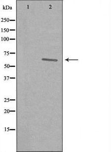 REC8 Antibody - Western blot analysis of extracts of K562 cells using REC8 antibody. The lane on the left is treated with the antigen-specific peptide.