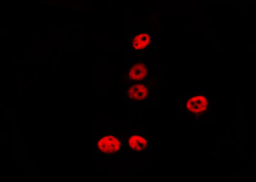 REC8 Antibody - Staining LOVO cells by IF/ICC. The samples were fixed with PFA and permeabilized in 0.1% Triton X-100, then blocked in 10% serum for 45 min at 25°C. The primary antibody was diluted at 1:200 and incubated with the sample for 1 hour at 37°C. An Alexa Fluor 594 conjugated goat anti-rabbit IgG (H+L) Ab, diluted at 1/600, was used as the secondary antibody.