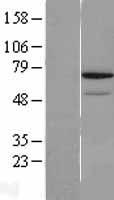 REC8 Protein - Western validation with an anti-DDK antibody * L: Control HEK293 lysate R: Over-expression lysate