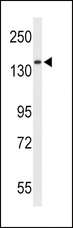 RECK Antibody - Western blot of RECK Antibody in HepG2 cell line lysates (35 ug/lane). RECK (arrow) was detected using the purified antibody.