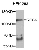 RECK Antibody - Western blot analysis of extracts of HEK-293 cells.