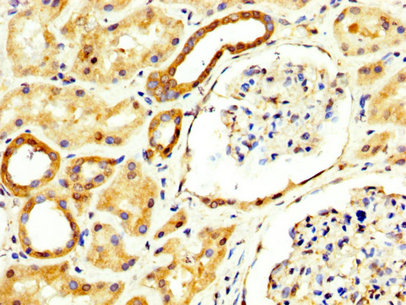 RECK Antibody - Immunohistochemistry image at a dilution of 1:300 and staining in paraffin-embedded human kidney tissue performed on a Leica BondTM system. After dewaxing and hydration, antigen retrieval was mediated by high pressure in a citrate buffer (pH 6.0) . Section was blocked with 10% normal goat serum 30min at RT. Then primary antibody (1% BSA) was incubated at 4 °C overnight. The primary is detected by a biotinylated secondary antibody and visualized using an HRP conjugated SP system.