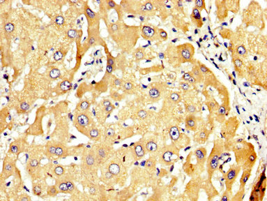 RECK Antibody - Immunohistochemistry image at a dilution of 1:300 and staining in paraffin-embedded human liver tissue performed on a Leica BondTM system. After dewaxing and hydration, antigen retrieval was mediated by high pressure in a citrate buffer (pH 6.0) . Section was blocked with 10% normal goat serum 30min at RT. Then primary antibody (1% BSA) was incubated at 4 °C overnight. The primary is detected by a biotinylated secondary antibody and visualized using an HRP conjugated SP system.