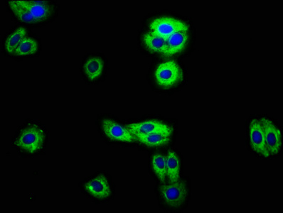 RECK Antibody - Immunofluorescence staining of HepG2 cells with RECK Antibody at 1:100, counter-stained with DAPI. The cells were fixed in 4% formaldehyde, permeabilized using 0.2% Triton X-100 and blocked in 10% normal Goat Serum. The cells were then incubated with the antibody overnight at 4°C. The secondary antibody was Alexa Fluor 488-congugated AffiniPure Goat Anti-Rabbit IgG(H+L).