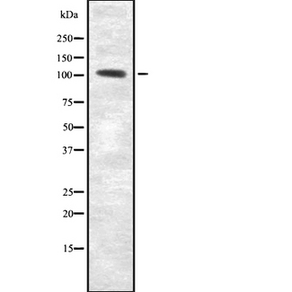 RECK Antibody - Western blot analysis of RECK using Jurkat whole cells lysates