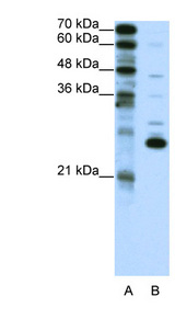 Recoverin Antibody - RCVRN / Recoverin antibody Western blot of Jurkat lysate. This image was taken for the unconjugated form of this product. Other forms have not been tested.
