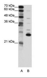 Recoverin Antibody - A: Marker, B: Jurkat Cell Lysate.  This image was taken for the unconjugated form of this product. Other forms have not been tested.
