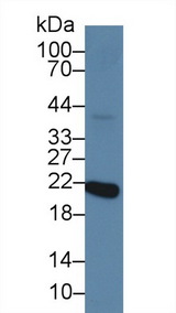 Recoverin Antibody - Western Blot; Sample: Mouse Eye lysate; Primary Ab: 2µg/ml Rabbit Anti-Human RCVRN Antibody Second Ab: 0.2µg/mL HRP-Linked Caprine Anti-Rabbit IgG Polyclonal Antibody