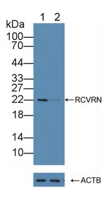 Recoverin Antibody - Knockout Varification: Lane 1: Wild-type WERI-RB-1 cell lysate; Lane 2: RCVRN knockout WERI-RB-1 cell lysate; Predicted MW: 23kd Observed MW: 22kd Primary Ab: 2µg/ml Rabbit Anti-Human RCVRN Antibody Second Ab: 0.2µg/mL HRP-Linked Caprine Anti-Rabbit IgG Polyclonal Antibody