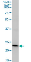 Recoverin Antibody - RCV1 monoclonal antibody (M37), clone 3F6. Western blot of RCV1 expression in A-431.