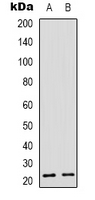 Recoverin Antibody - Western blot analysis of Recoverin expression in Y79 (A); NIH3T3 (B) whole cell lysates.