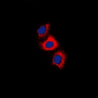 Recoverin Antibody - Immunofluorescent analysis of Recoverin staining in HeLa cells. Formalin-fixed cells were permeabilized with 0.1% Triton X-100 in TBS for 5-10 minutes and blocked with 3% BSA-PBS for 30 minutes at room temperature. Cells were probed with the primary antibody in 3% BSA-PBS and incubated overnight at 4 deg C in a humidified chamber. Cells were washed with PBST and incubated with a DyLight 594-conjugated secondary antibody (red) in PBS at room temperature in the dark. DAPI was used to stain the cell nuclei (blue).