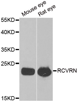 Recoverin Antibody - Western blot analysis of extracts of various tissues.